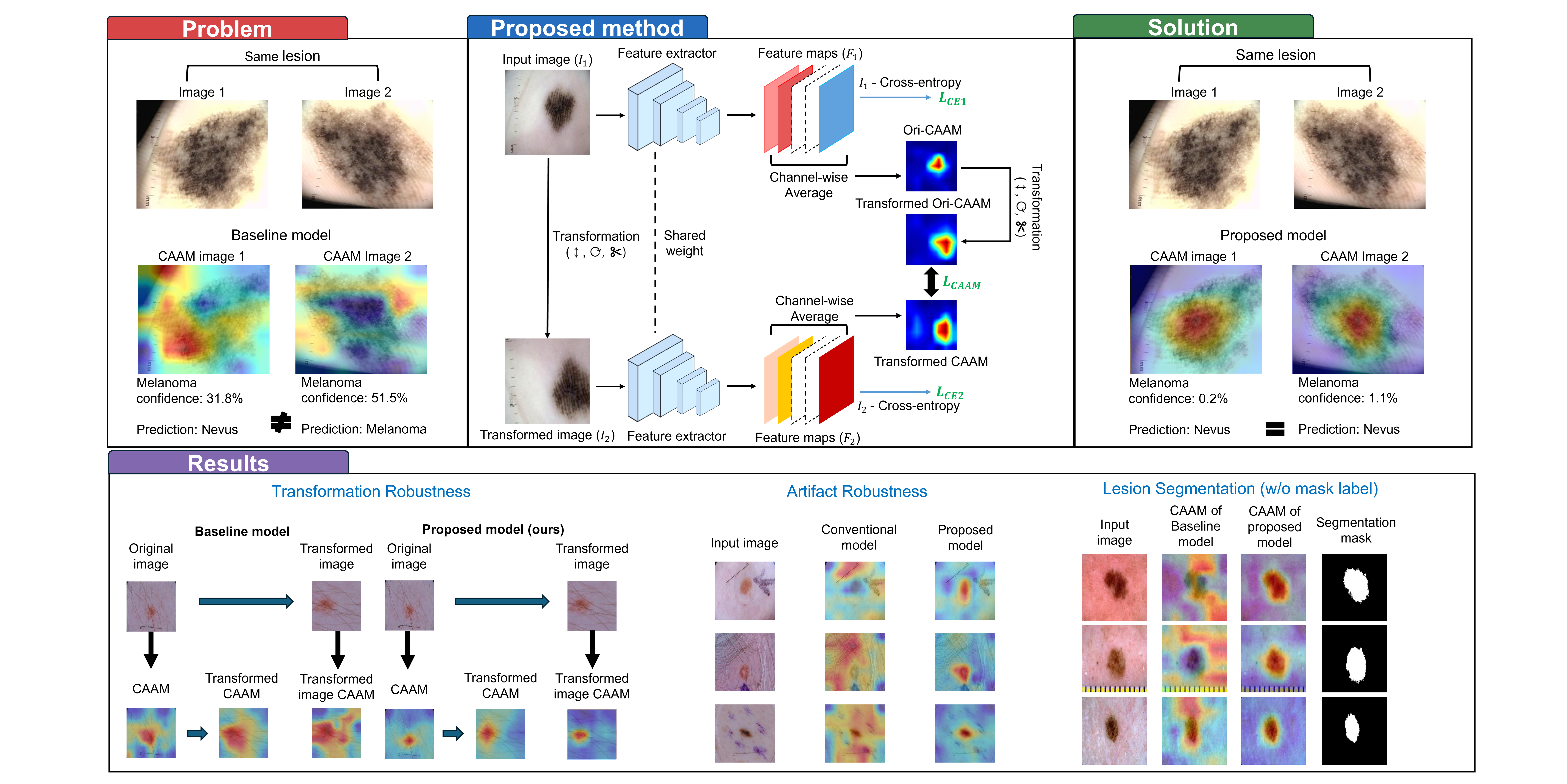 Robust melanoma prediction overview